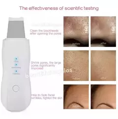 Espátula Facial Ultrasónica Peeling Skin Scrubber Recargable - comprar online