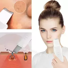 Espátula Facial Ultrasónica Peeling Skin Scrubber Recargable - mqregalosmayorista