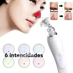 Removedor Extractor Puntos Negros Espinillas Con Loción - comprar online