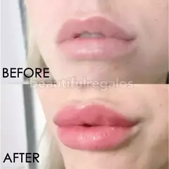 Labial Con Colageno Agrandar Labios Hidratado Maximizador en internet
