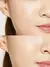 Acne pimple Master 24 patches en internet