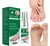 Tratamiento Spray Hongo Uñas Onicomicosis Micosis Pie Atleta
