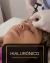 Hialurónico