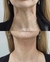 Botox en el cuello - comprar online