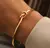 Bracelete Nózin na internet
