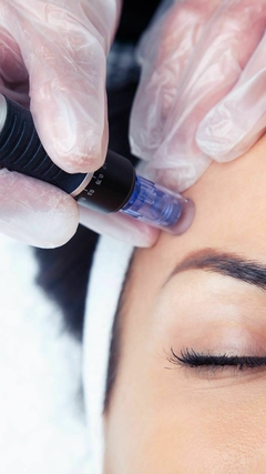Dermapen