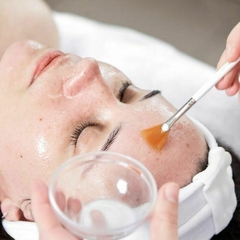 Peeling Químico