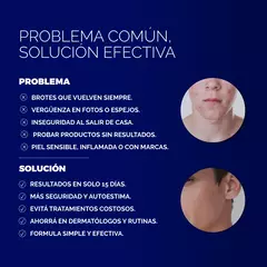 Pack para Acné - CLEAN FACE - BEAUTY COSMETICS