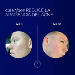 Imagen de Pack para Acné - CLEAN FACE