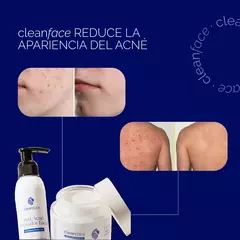 Pack para Acné - CLEAN FACE - tienda online