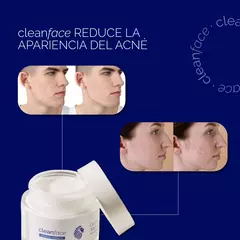 Crema para Acné 50ml - CLEAN FACE - comprar online