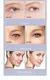 SkinPro: Dispositivo Multifuncional de Radiofrequência para Cuidados Faciais
