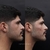 Preenchimento Facial - Clinica Gadelha