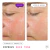 MAT-1040 Major Fade Hyper Serum - Dr. !driss $608 en internet