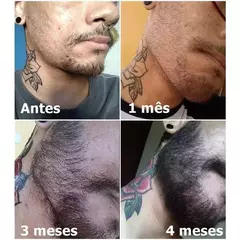 Kit Crescimento: Shampoo + Minoxidil - Eaê Cosméticos - Glosscaty Cosméticos