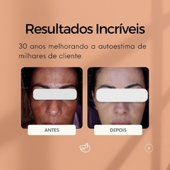 Creme Facial Clareador Nova Pele Melasma na internet