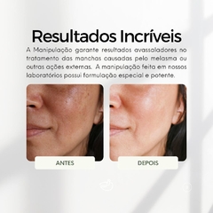 Creme Facial Clareador Nova Pele Melasma (KIT 3 UNIDADES) - Pele Linda