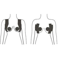 I-BRA CINTA PARA PEZONERAS Y MODELAR BUSTO 2 PAR DE PEZONERA 9 MT COLOR NUDE 70 - tienda online