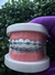 Brackets falsos cadenas corridas en internet