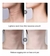 PROMO FLASH EN SKIN LIFTER ⭐⭐⭐⭐⭐ (4,95) - tienda online