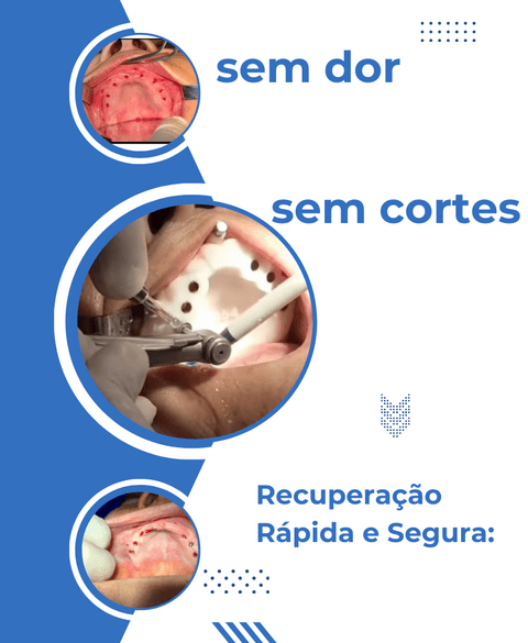 Carrossel 1