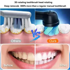 Escova de dentes elétrica rotativa para adulto
