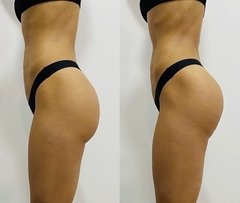 20 SESIONES PROSCULPT, TONIFICA, LEVANTA, MARCA, DESARROLLA MUSCULO... ETC