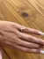 Anillo Mei