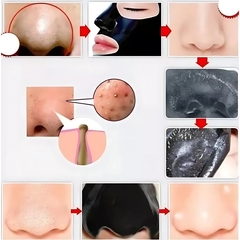Ultra Rejuvenecedor ANLAN + 2 Mascarillas Faciales Black PREMIUM de Regalo!! - comprar online