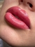 Preenchimento Labial