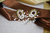 Aretes