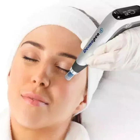 Mujer recibiendo un tratamiento facial sencillo con un dispositivo Dermapen en un ambiente de belleza y salud. Spanix