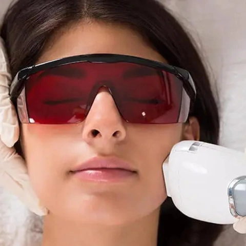 Mujer recibiendo un tratamiento de depilación láser en la cara, usando gafas protectoras. Spanix