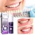 Clareador Dental V34 EELHOE – Sorriso Perfeito - FaelShop