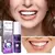 Clareador Dental V34 EELHOE – Sorriso Perfeito