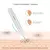 CANETA LASER DE PLASMA REMOVEDORA DE VERRUGAS, MANCHAS DE PELE COMO PAPILOMAS, SARDAS, MANCHAS ESCURAS, KIT CAUTERIZADOR USB - loja online
