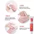 Creme de remoção rápida de cicatriz velha, queimadura helóide, cicatriz cirúrgica, acne, estrias, tratamento, pomada, reparação suave, rosto, corpo, cuidados com a pele, gel - comprar online