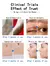 Imagem do Creme de remoção rápida de cicatriz velha, queimadura helóide, cicatriz cirúrgica, acne, estrias, tratamento, pomada, reparação suave, rosto, corpo, cuidados com a pele, gel