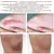 Creme de remoção rápida de cicatriz velha, queimadura helóide, cicatriz cirúrgica, acne, estrias, tratamento, pomada, reparação suave, rosto, corpo, cuidados com a pele, gel - Irislandia Variedades