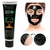 Máscaras Preta Removedora De Cravos Para Skin Care Matto Verde - Lopes Valentim