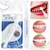 Lapiz Blanqueador TotalWhite