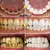 Sorriso radiante e confiante! Essência para clareamento dental para remover manchas e placa bacteriana, resultados visíveis! - Carlo Collection - A sua loja de variedades completa