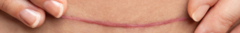 Banner de la categoría Fisioterapia