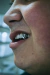 Grillz fire on internet