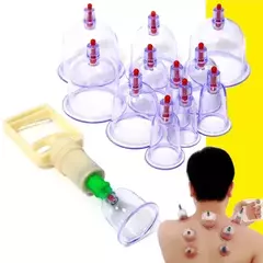 Set Vetosas Vacumterapia - comprar en línea