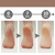Soft Feet - Removedor de Calos Rachaduras dos Pés na internet