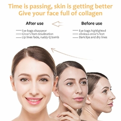 Masajeador Rejuvenedor Facial - Reuni