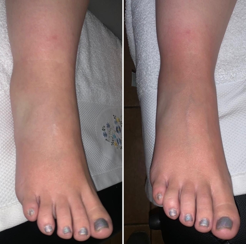 Drenaje Linfático Manual 1 SESIÓN - comprar en línea