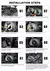 2 unidades LED de 360 graus 140000 LM H7 H11 Lâmpada LED H1 H4 H8 H9 9005 HB3 9