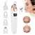 Blackhead remover - online store